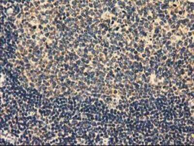 Immunohistochemistry: MMAB Antibody (OTI2G5) - Azide and BSA Free [NBP2-72730]