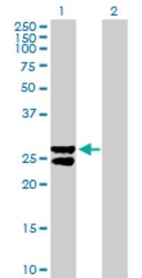 Western Blot: MMAB Antibody [H00326625-B02P]