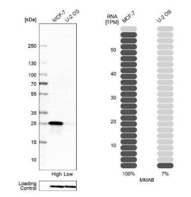 Western Blot: MMAB Antibody [NBP1-86602]