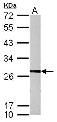 Western Blot: MMAB Antibody [NBP2-17308]