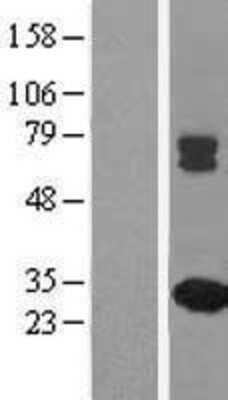 Western Blot: MMAB Overexpression Lysate [NBL1-13143]