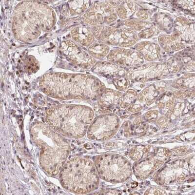 Immunohistochemistry-Paraffin: MMACHC Antibody [NBP1-86598]