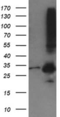 Western Blot: MMACHC Antibody (OTI1A4)Azide and BSA Free [NBP2-72738]