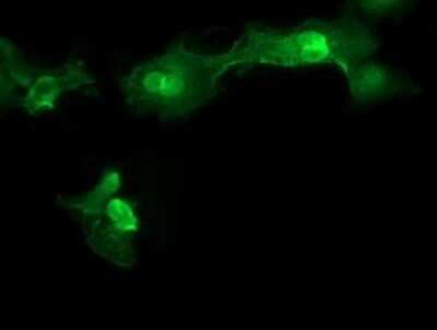 Immunofluorescence: MMACHC Antibody (OTI1A4) [NBP2-45884]