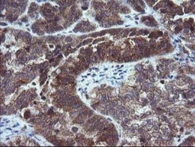 Immunohistochemistry: MMACHC Antibody (OTI1A4) [NBP2-45884]