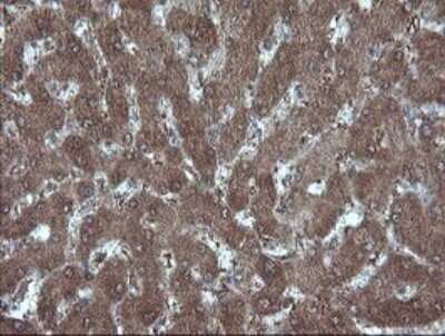 Immunohistochemistry: MMACHC Antibody (OTI1A4) [NBP2-45884]