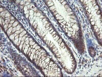 Immunohistochemistry: MMACHC Antibody (OTI1A4) [NBP2-45884]