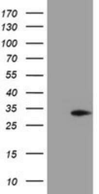 Western Blot: MMACHC Antibody (OTI4E9)Azide and BSA Free [NBP2-72734]