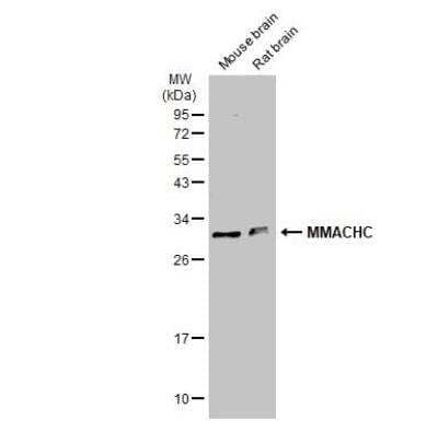 Western Blot: MMACHC Antibody [NBP1-32513]