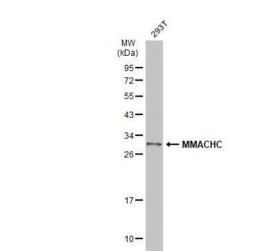 Western Blot: MMACHC Antibody [NBP1-32513]