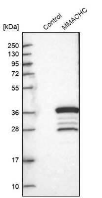 Western Blot: MMACHC Antibody [NBP1-86597]