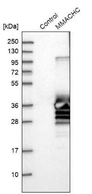 Western Blot: MMACHC Antibody [NBP1-86598]