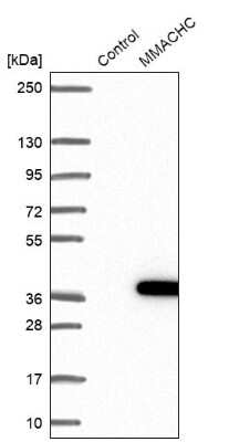 Western Blot: MMACHC Antibody [NBP2-48582]