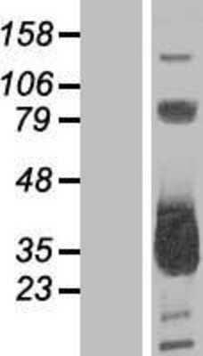 Western Blot: MMACHC Overexpression Lysate [NBL1-13144]