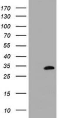 Western Blot: MMADHC Antibody (OTI1G4) [NBP2-45885]