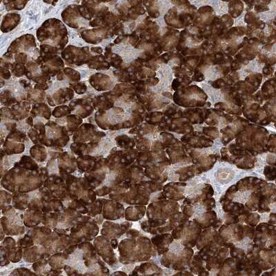 Immunohistochemistry-Paraffin: MMADHC Antibody [NBP1-86804]