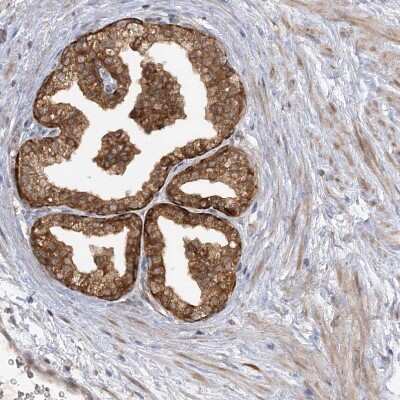 Immunohistochemistry-Paraffin: MMADHC Antibody [NBP2-38351]