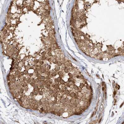 Immunohistochemistry-Paraffin: MMADHC Antibody [NBP2-38351]