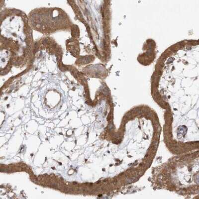 Immunohistochemistry-Paraffin: MMADHC Antibody [NBP2-38351]