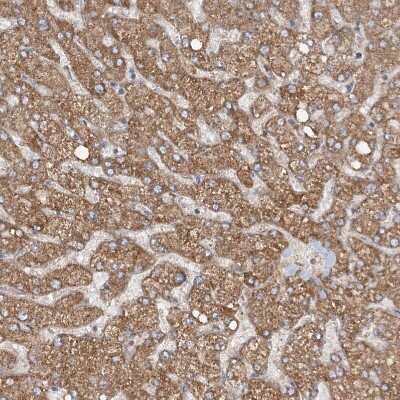 Immunohistochemistry-Paraffin: MMADHC Antibody [NBP2-38351]
