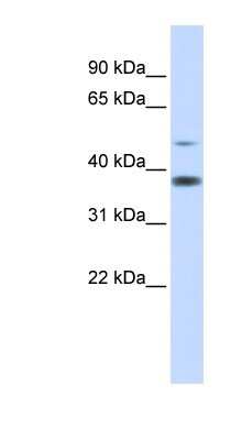 Western Blot: MMADHC Antibody [NBP1-54708]