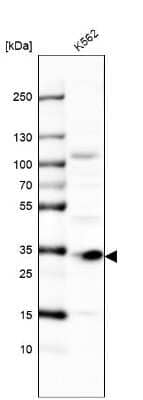 Western Blot: MMADHC Antibody [NBP2-38351]