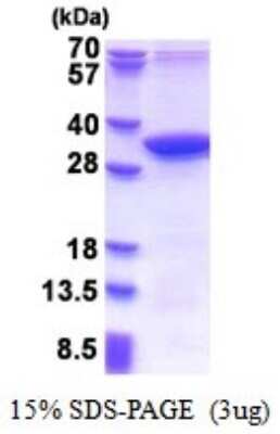 SDS-PAGE: Recombinant Human MMADHC His Protein [NBP2-51545]