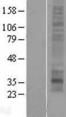 Western Blot: MMD2 Overexpression Lysate [NBP2-04734]