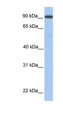 Western Blot: Neprilysin-2/MMEL1 Antibody [NBP1-59349]