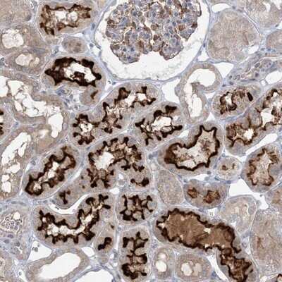 Immunohistochemistry-Paraffin: MMGT1 Antibody [NBP1-90652]