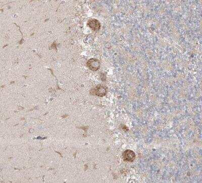 Immunohistochemistry-Paraffin: MMGT1 Antibody [NBP1-90652]