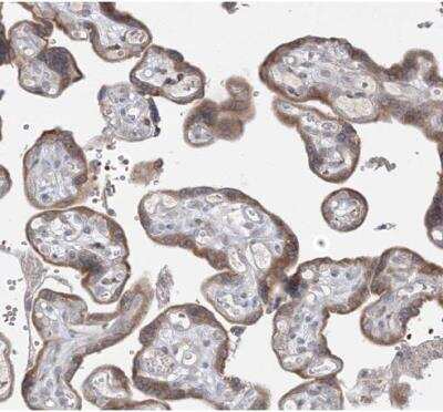 Immunohistochemistry-Paraffin: MMGT1 Antibody [NBP1-90652]