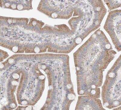 Immunohistochemistry-Paraffin: MMGT1 Antibody [NBP1-90652]