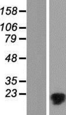 Western Blot: MMGT1 Overexpression Lysate [NBP2-05139]