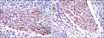 Immunohistochemistry-Paraffin: MMP-1 Antibody (6A5) - Azide and BSA Free [NBP2-80852]