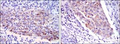 Immunohistochemistry-Paraffin: MMP-1 Antibody (6A5) - BSA Free [NBP2-22123]