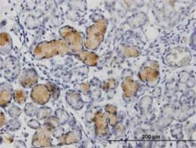 Immunohistochemistry-Paraffin: MMP-1 Antibody [H00004312-D01P]