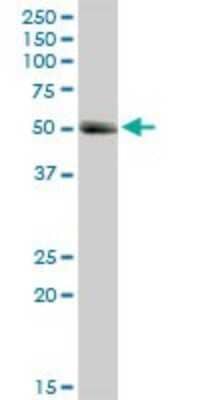 Western Blot: MMP-1 Antibody [H00004312-D01P]