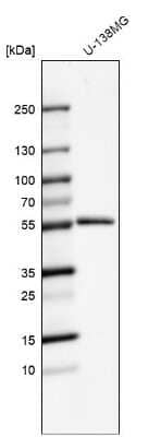 Western Blot: MMP-1 Antibody [NBP2-55118]