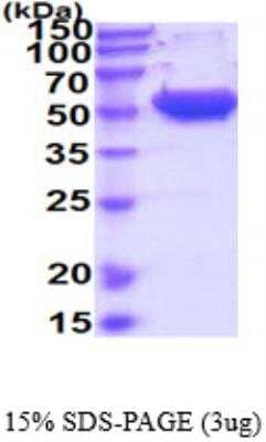 SDS-PAGE: Recombinant Human MMP-1 His Protein [NBP2-52617]