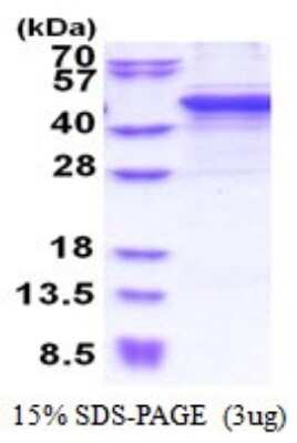 SDS-PAGE: Recombinant Human MMP-10 His Protein [NBP2-51553]