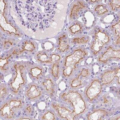 Immunohistochemistry-Paraffin: MMP-11 Antibody [NBP2-49575]