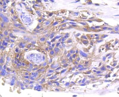 Immunohistochemistry-Paraffin: MMP-11 Antibody (SN74-08) [NBP2-67670]