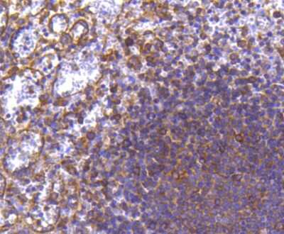 Immunohistochemistry-Paraffin: MMP-11 Antibody (SN74-08) [NBP2-67670]