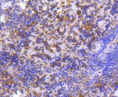 Immunohistochemistry-Paraffin: MMP-11 Antibody (SN74-08) [NBP2-67670]
