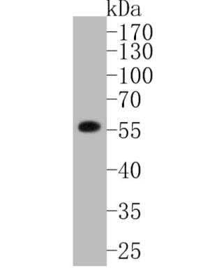 Western Blot: MMP-11 Antibody (SN74-08) [NBP2-67670]