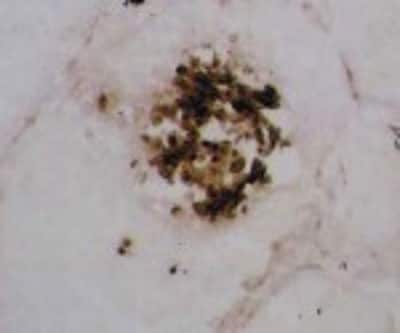 Immunohistochemistry-Frozen: MMP-12 Antibody (603E6.22) [DDX0280P-100]