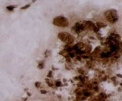 Immunohistochemistry: MMP-12 Antibody (703D10) [DDX0283P-100]