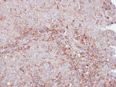 Immunohistochemistry-Paraffin: MMP-12 Antibody [NBP1-31225]