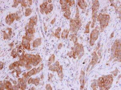 Immunohistochemistry-Paraffin: MMP-12 Antibody [NBP1-31225]
